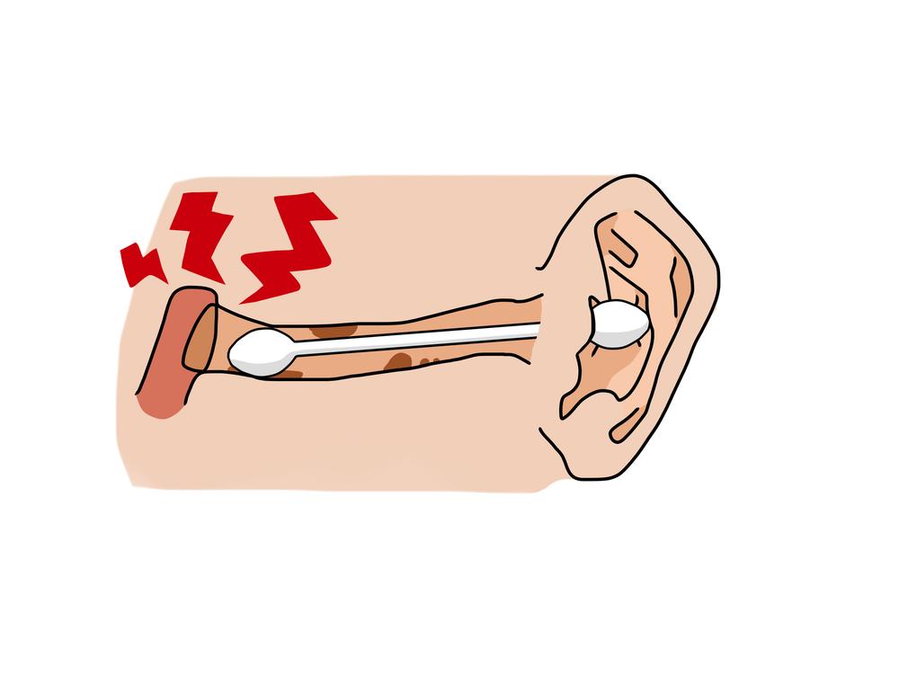 外耳炎の症状イメージ｜耳のかゆみや痛み、耳だれなど