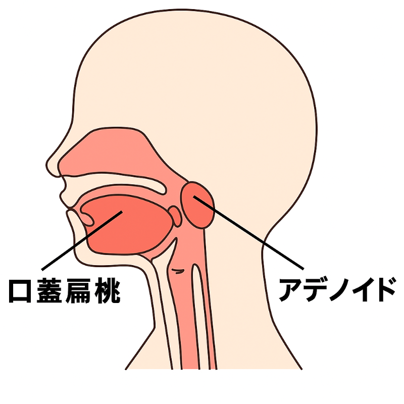 口蓋扁桃とアデノイドを示すイメージ│扁桃・アデノイドが肥大する