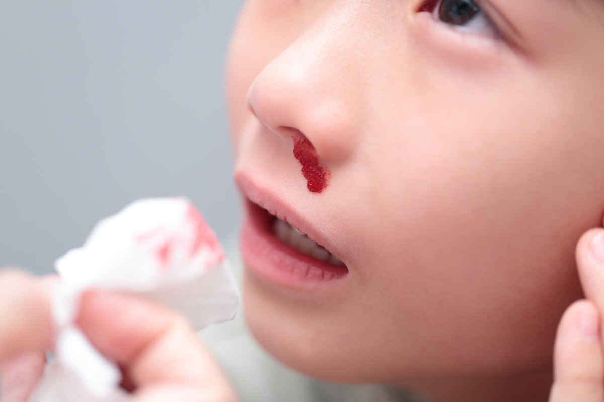 鼻血で困っている子どものイメージ│鼻血はなぜ起こる？原因と背景