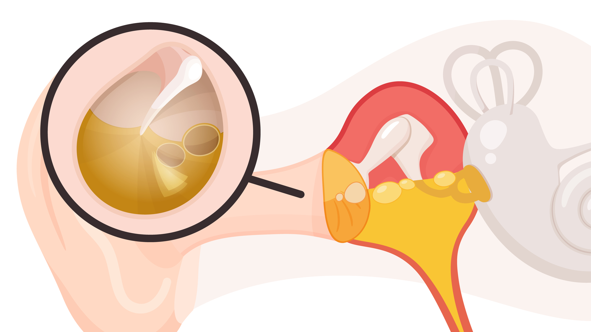 耳だれ（耳漏）の説明イメージ